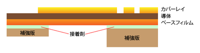 補強板の構成例